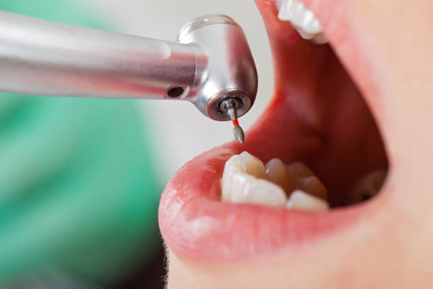 Best Emergency Broken Tooth Repair in Floresville, TX